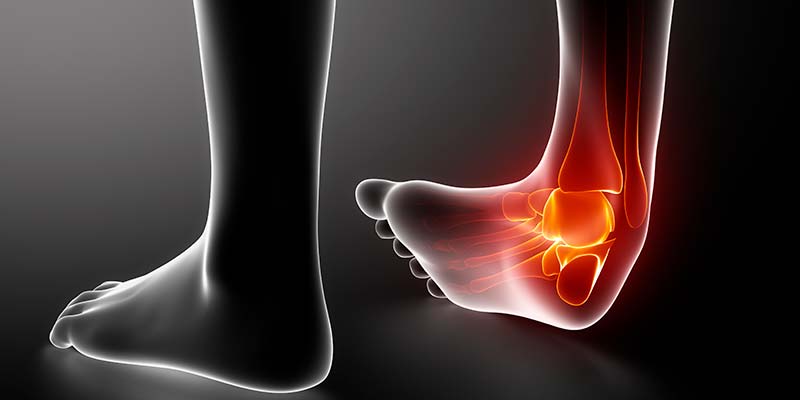 Anatomía del tobillo cuando se produce un esguince